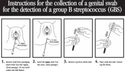 Image result for Group B Streptococcus Prophylaxis