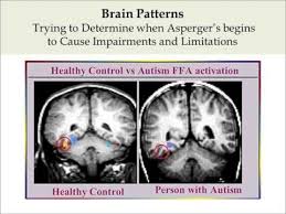 Helping different kinds of minds succeed. Asperger S Syndrome Just A Piece Of The Puzzle Youtube