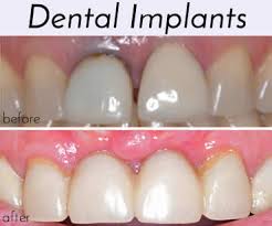 We did not find results for: Oklahoma Center For Implants Periodontics