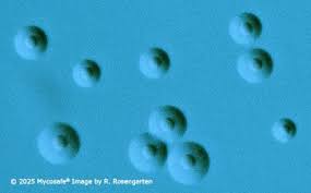 Image result for Mycoplasma