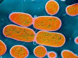 Image result for Shigella