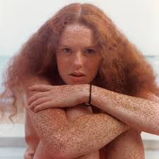 Image result for Freckles