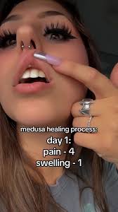 Medusa Piercing Healing: My Day 6 Experience