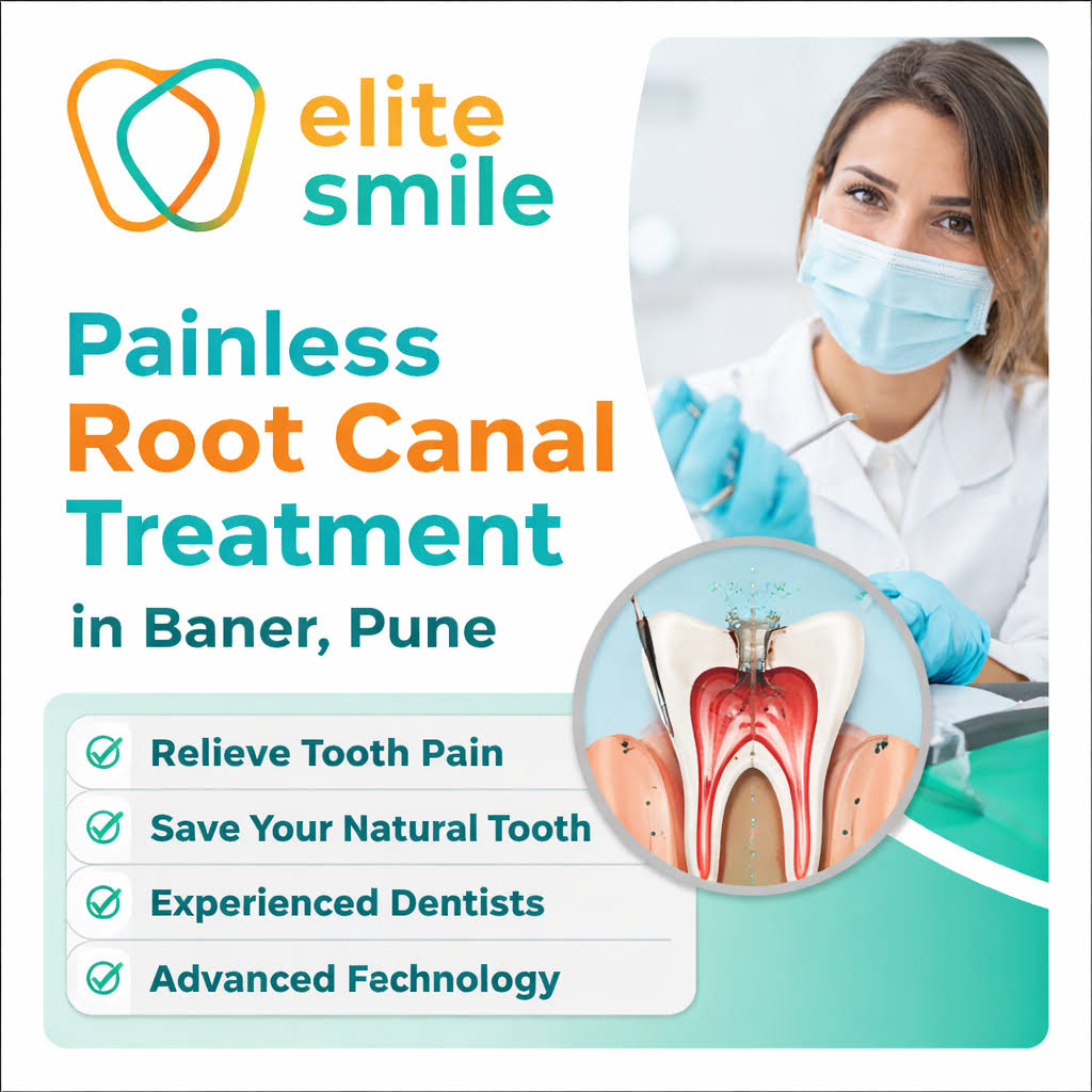 Root Canal Treatment in Baner, Pune product image