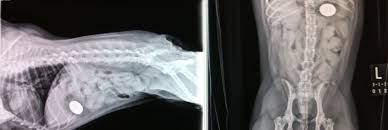 Coin Ingestion Radiologie