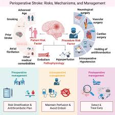 Image result for CVA Management