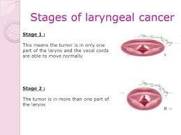 The signs and symptoms of throat cancer may be difficult to identify in the early stages of the disease. Laryngeal Tumors Ppt Video Online Download