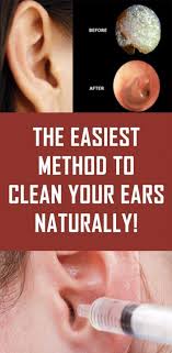 The Easiest Method To Clean Your Ears Naturally Cleaning Your Ears Dry Skin Routine Blocked Ear Remedies