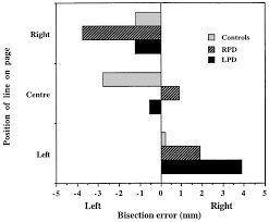 Using the idea of bisection search, write a recursive algorithm that checks if a character is included within a string, as long as the string is in alphabetical order. Evidence From A Line Bisection Task For Visuospatial Neglect In Left Hemiparkinson S Disease Sciencedirect