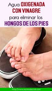 3 pomadas para los hongos en los pies con efecto antimicótico que resuelven el problema de raíz el pie de atleta y los hongos en las uñas,son las principales afecciones de hongos que se pueden. Pin On Salud
