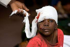 Hundreds of thousands of survivors were displaced. Casualties Of The 2010 Haiti Earthquake Wikipedia