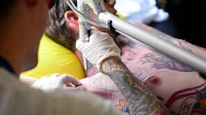 Maybe you would like to learn more about one of these? Tattoo Removal How To Costs Before And After Pictures More