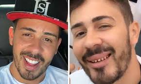 Kevinho postou foto comparativa (imagem: Kevinho Compartilha Fotos Dos Dentes Sem Lentes E Diverte Internautas