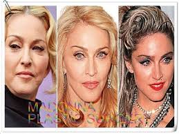 Since then, he's worn a prosthetic nose to hide the huge. Madonna Plastic Surgery Plastic Surgery Bad Plastic Surgeries Plastic Surgery Photos