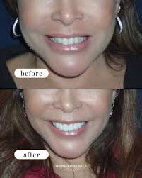 Smile Maker of Texas