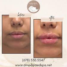 The Concept ATL, 255 Village Pkwy NE, Marietta, GA 30067, US