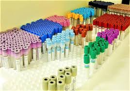 color codes of vacutainer tubes and its uses