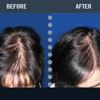 Find the best obgyn in lawrenceville, nj. Hair Loss Control Clinic Hlcc Sabrina S Ultimate Touch Salon Lawrenceville Nj Cosmetics Shop In Lawrenceville