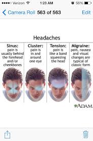 A Migraine 1 Relax 2 Have A Table Spoon Of Benadryl It Relaxes You 3 Take One 1 Ibuprofen H2o Migraines Remedies Migraine Migraine Cure