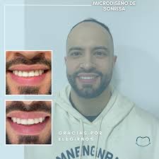 🦷💫 ¿Crees que tú que tú sonrisa solo depende de tus dientes? Mi pasión va  más allá de un solo chequeo, acompañó procesos reales de transformación  donde devuelvo no sólo la sonrisa,