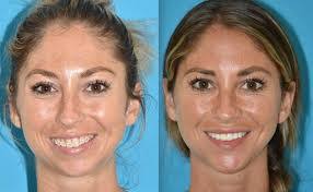 Bart Hyde's Instagram, Twitter & Facebook