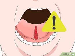 Well if you want your tongue to be longer, you need to cut that little sumbitch. How To Get A Longer Tongue 8 Steps With Pictures Wikihow
