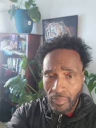 Upcoming Excess Skin Surgery After Significant Weight Loss