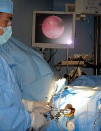 C'est autoriser a 18 ans ? Cabinet Gynecologie Ste Maxime Ligature Des Trompes