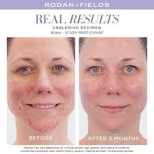 Lisa Stenger Martin's Rodan+Fields Biz