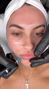 How about a little @hydrafacial to kickstart your Friday? We invite you to  come experience this for yourself! You won’t regret it! , 🎥: @hydrafacial  , #skincare #skin #skincaretips #skinhealth #facial ...