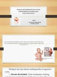 Maybe you would like to learn more about one of these? Makalah Keperawatan Anak Hernia Diafragma Ppt Autosaved