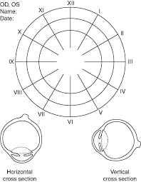 Fundus Examination Springerlink