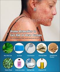Pin On Diy Health