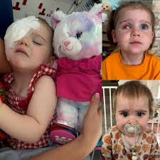 See More ➡️: https://news.m30.works/19/ At just 14 months old, Ava was diagnosed with retinoblastoma, a rare eye cancer 👁️💔. To save her life, doctors had to remove her eye 🏥🙏. What followed