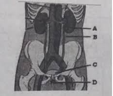 Kunci jawaban soal pas / uas pkn sma kelas 11 semester 1 tahun 2020. Contoh Soal Dengan Jawaban Pkn Kelas Xi Ummar Dany Jawabanku Id