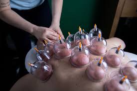 Official medal count for the tokyo 2020 olympics. What Is Cupping And Its Benefits Empowered Wellness