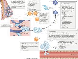 The cancer gets its name because is causes symptoms that are similar to a breast infection. Inflammatory Breast Cancer Biology The Tumour Microenvironment Is Key Nature Reviews Cancer