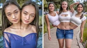 JUST NOW:Discover the Unseen World of Siamese Twins: Top 15 Extraordinary Cases...see full detail 👇🏻 https://g2w2.short.gy/diddynewsthreads4