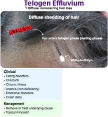 Image result for Hair Pull Test