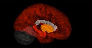 Gene Signature In Healthy Brains Pinpoints The Origins Of Alzheimer S Disease Healthy Brain Alzheimers Teenage Brain