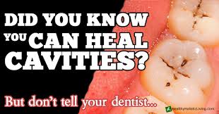 However, there is no scientific evidence to back this up, and experts don't recommend it.4 x trustworthy source prepare for a cavity filling. Can You Cure Cavities Or Is It A Myth A A Dental Centre