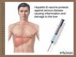 Check spelling or type a new query. Asuhan Keperawatan Klien Dengan Sirosis Hepatis Ppt Download