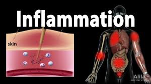 نتیجه جستجوی لغت [inflammatory] در گوگل