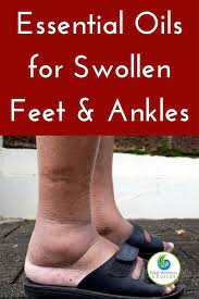 Top 5 Essential Oils For Swollen Feet And Ankles Best Essential Oils Essential Oils Health Essential Oil Benefits