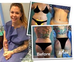 We did not find results for: What Plastic Surgery Procedures Did Kailyn Lowry Have Done