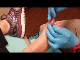 Pin On Faant Doctor Blogs