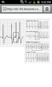 Pvcs To V Tach Oh How Very Very Much I Do Know This M Nursing Education Rn School Nurse