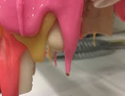 Oxidation commonly occurs on outdoor furniture such as resin plastic chairs, and is caused from prolonged exposure to the sun. No Your Furniture Shouldn T Drip Or Burst The New York Times