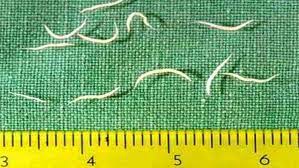 Cacing pita terbilang mengerikan karena bisa tumbuh di dalam tubuh manusia hingga berukuran 15 cm dan hidup selama 30 tahun. Mengerikan 7 Cacing Parasit Ini Bisa Hidup Di Dalam Tubuhmu Tiba Tiba