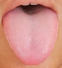 Sample Image Of A Healthy Tongue Download Scientific Diagram